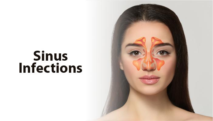 What causes chronic sinus infections, and how to prevent them?